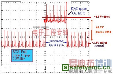 1.5英尺以外的发射器开启和关闭时ECG诊断设备的心脏检查结果