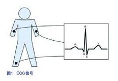 心电图机
