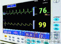 ���˼໤������ʾ��ECG��Ѫ������